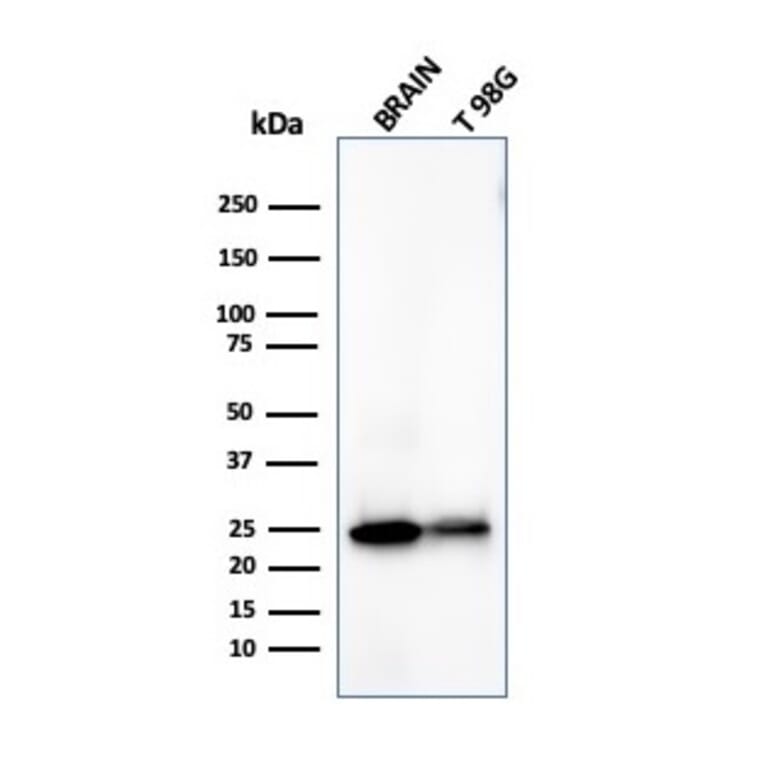 Western Blot - Anti-PGP9.5 Antibody [UCHL1/4558] - BSA and Azide free (A253457) - Antibodies.com