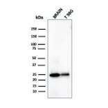 Western Blot - Anti-PGP9.5 Antibody [UCHL1/4558] - BSA and Azide free (A253457) - Antibodies.com