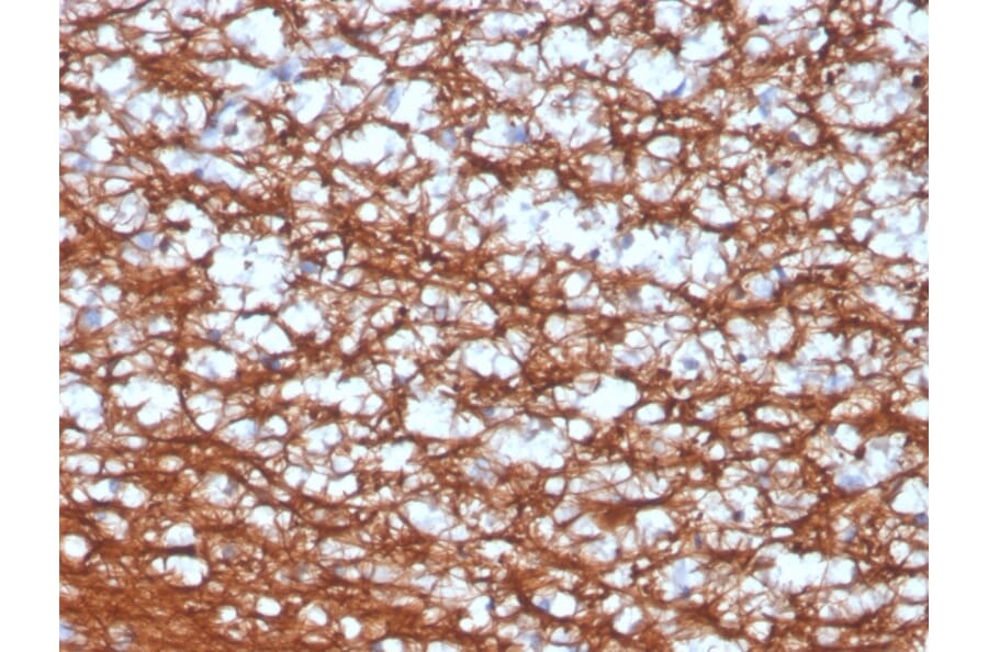 Immunohistochemistry - Anti-PGP9.5 Antibody [UCHL1/4556R] - BSA and Azide free (A253457) - Antibodies.com