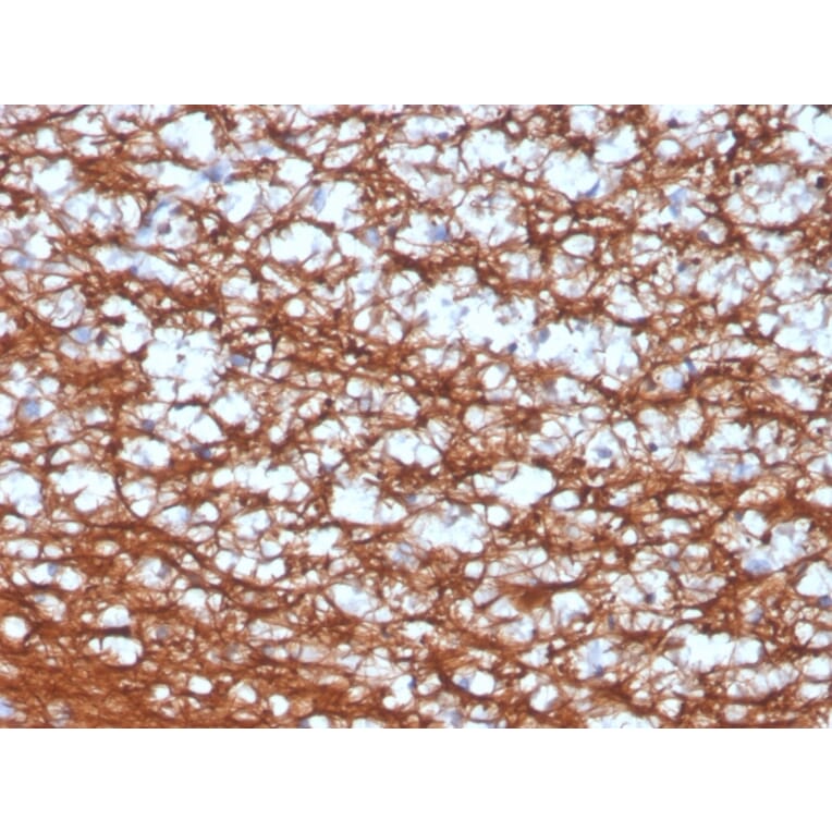 Immunohistochemistry - Anti-PGP9.5 Antibody [UCHL1/4556R] - BSA and Azide free (A253457) - Antibodies.com