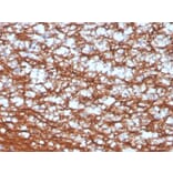 Immunohistochemistry - Anti-PGP9.5 Antibody [UCHL1/4556R] - BSA and Azide free (A253457) - Antibodies.com