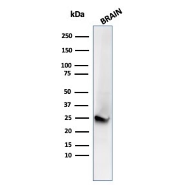 Western Blot - Anti-PGP9.5 Antibody [UCHL1/4556R] - BSA and Azide free (A253458) - Antibodies.com