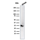 Western Blot - Anti-PGP9.5 Antibody [UCHL1/4556R] - BSA and Azide free (A253458) - Antibodies.com