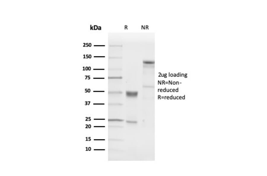 SDS-PAGE - Anti-PGP9.5 Antibody [UCHL1/4556R] - BSA and Azide free (A253458) - Antibodies.com