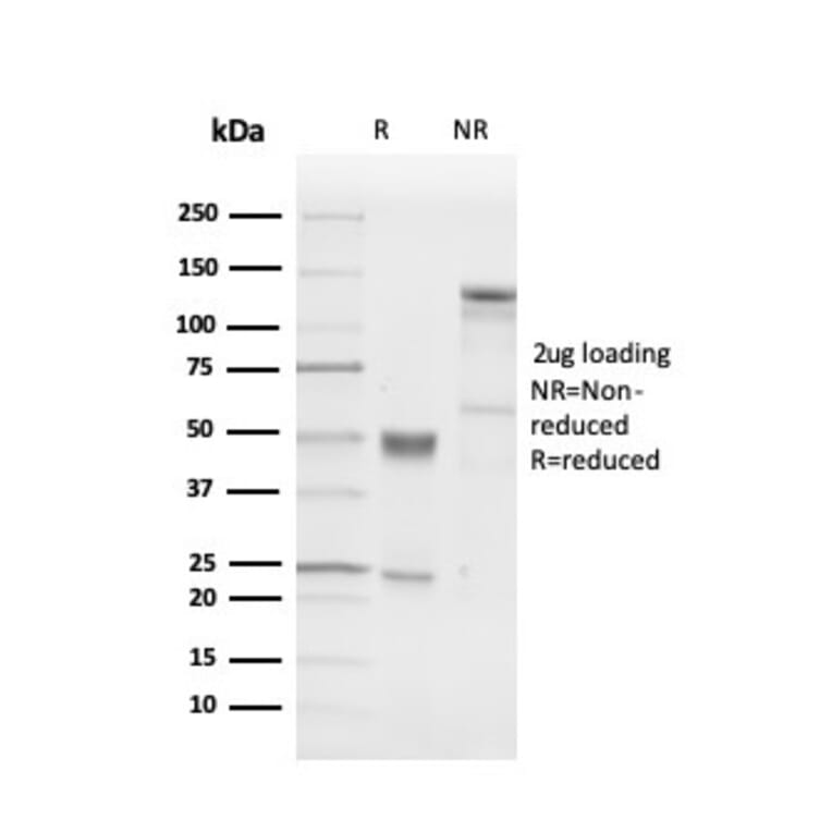 SDS-PAGE - Anti-PGP9.5 Antibody [UCHL1/4556R] - BSA and Azide free (A253458) - Antibodies.com