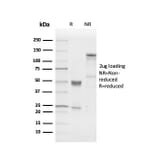 SDS-PAGE - Anti-PGP9.5 Antibody [UCHL1/4556R] - BSA and Azide free (A253458) - Antibodies.com