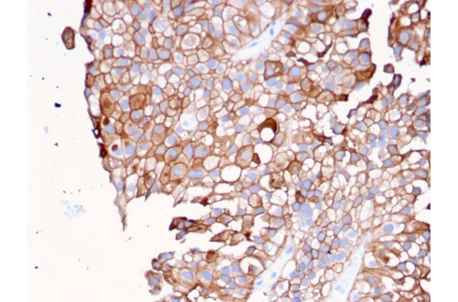 Immunohistochemistry - Anti-Uroplakin 1B Antibody [UPK1B/3081] - BSA and Azide free (A253459) - Antibodies.com