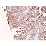 Immunohistochemistry - Anti-Uroplakin 1B Antibody [UPK1B/3081] - BSA and Azide free (A253459) - Antibodies.com