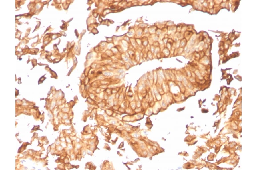 Immunohistochemistry - Anti-Uroplakin 1B Antibody [UPK1B/3081] - BSA and Azide free (A253459) - Antibodies.com