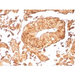 Immunohistochemistry - Anti-Uroplakin 1B Antibody [UPK1B/3081] - BSA and Azide free (A253459) - Antibodies.com