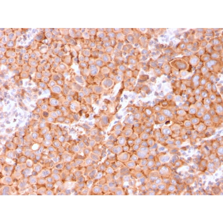 Immunohistochemistry - Anti-Uroplakin 1B Antibody [UPK1B/3081] - BSA and Azide free (A253459) - Antibodies.com