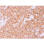 Immunohistochemistry - Anti-Uroplakin 1B Antibody [UPK1B/3081] - BSA and Azide free (A253459) - Antibodies.com