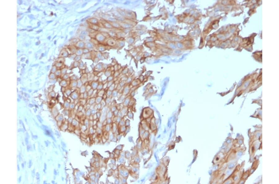Immunohistochemistry - Anti-Uroplakin 1B Antibody [UPK1B/3102] - BSA and Azide free (A253460) - Antibodies.com