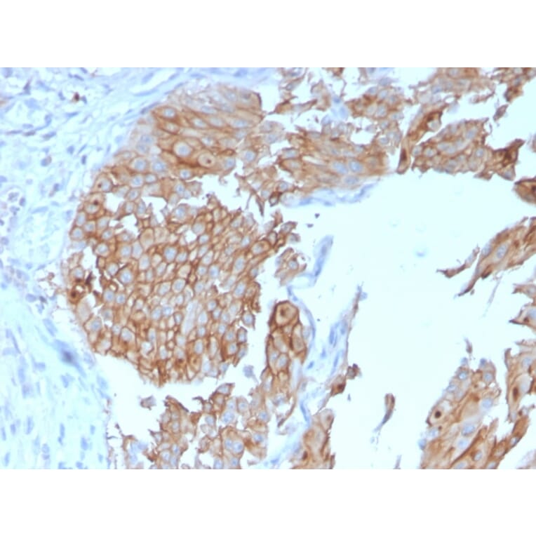 Immunohistochemistry - Anti-Uroplakin 1B Antibody [UPK1B/3102] - BSA and Azide free (A253460) - Antibodies.com