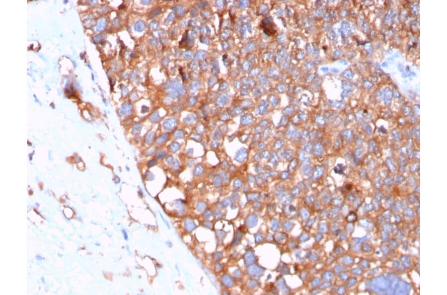 Immunohistochemistry - Anti-Uroplakin 1B Antibody [UPK1B/3102] - BSA and Azide free (A253460) - Antibodies.com