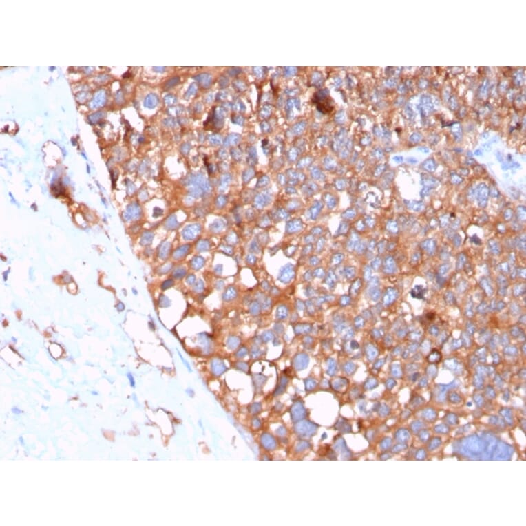 Immunohistochemistry - Anti-Uroplakin 1B Antibody [UPK1B/3102] - BSA and Azide free (A253460) - Antibodies.com