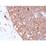 Immunohistochemistry - Anti-Uroplakin 1B Antibody [UPK1B/3102] - BSA and Azide free (A253460) - Antibodies.com