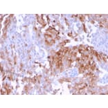 Immunohistochemistry - Anti-Uroplakin 1B Antibody [UPK1B/3102] - BSA and Azide free (A253460) - Antibodies.com