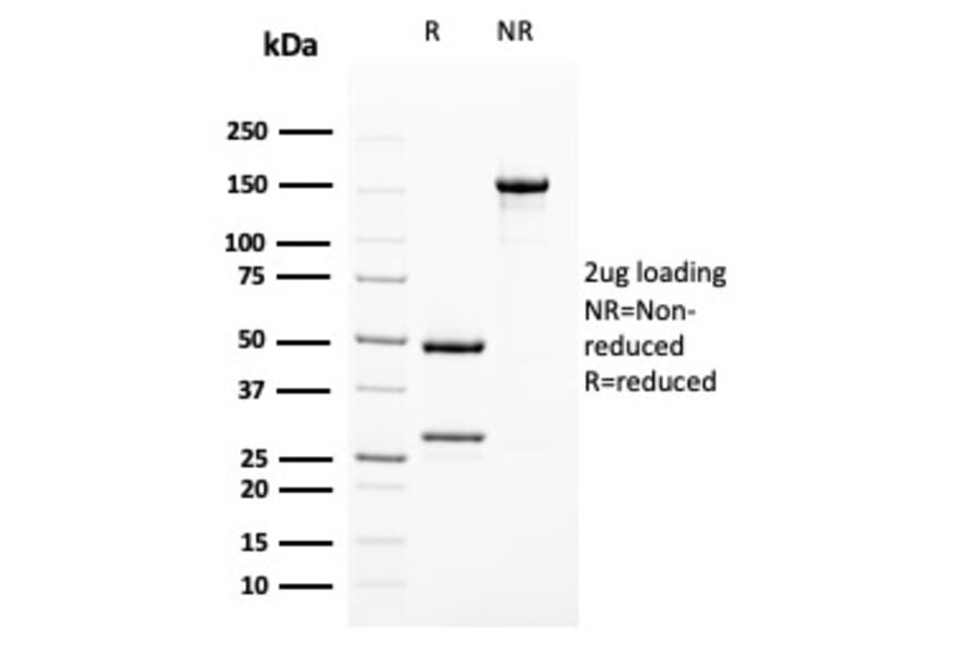 SDS-PAGE - Anti-Uroplakin 1B Antibody [UPK1B/3102] - BSA and Azide free (A253460) - Antibodies.com