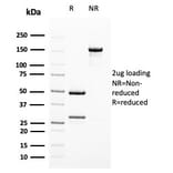 SDS-PAGE - Anti-Uroplakin 1B Antibody [UPK1B/3102] - BSA and Azide free (A253460) - Antibodies.com