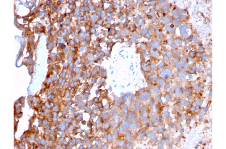 Immunohistochemistry - Anti-Uroplakin 1B Antibody [UPK1B/3273] - BSA and Azide free (A253461) - Antibodies.com