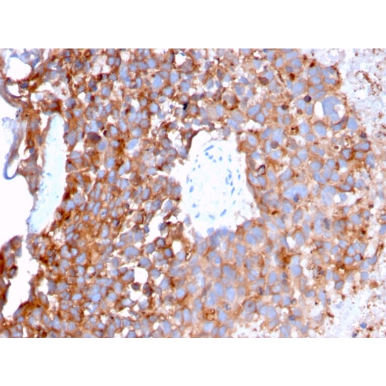 Immunohistochemistry - Anti-Uroplakin 1B Antibody [UPK1B/3273] - BSA and Azide free (A253461) - Antibodies.com