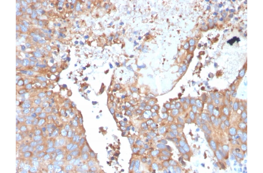 Immunohistochemistry - Anti-Uroplakin 1B Antibody [UPK1B/3273] - BSA and Azide free (A253461) - Antibodies.com