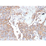Immunohistochemistry - Anti-Uroplakin 1B Antibody [UPK1B/3273] - BSA and Azide free (A253461) - Antibodies.com