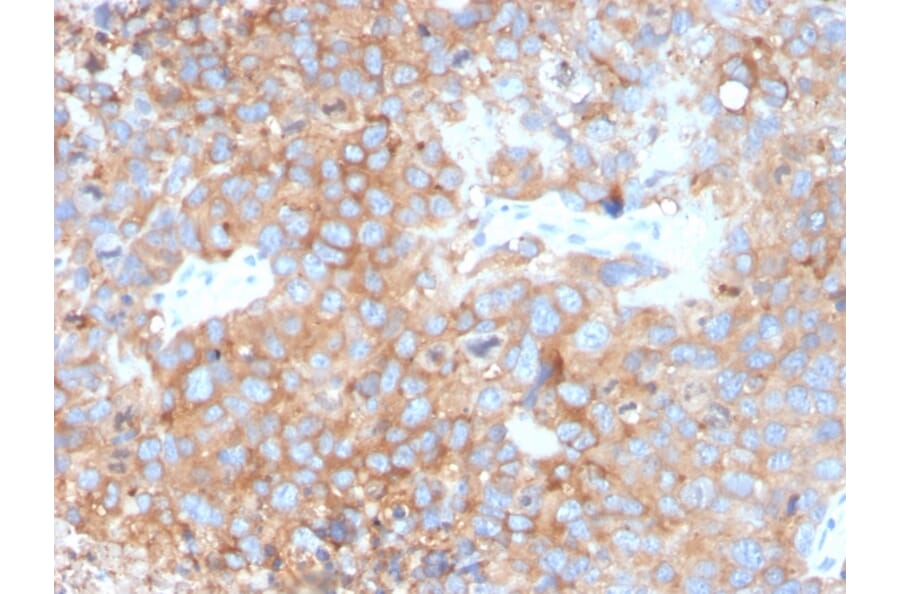 Immunohistochemistry - Anti-Uroplakin 1B Antibody [UPK1B/3273] - BSA and Azide free (A250281) - Antibodies.com