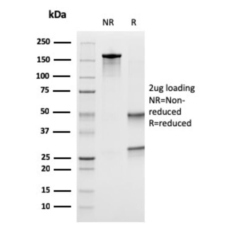 SDS-PAGE - Anti-Uroplakin 1B Antibody [UPK1B/3273] - BSA and Azide free (A250281) - Antibodies.com