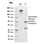 SDS-PAGE - Anti-Uroplakin 1B Antibody [UPK1B/3273] - BSA and Azide free (A250281) - Antibodies.com