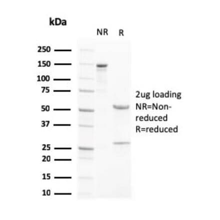 SDS-PAGE - Anti-Liver X Receptor beta Antibody [LXRB/2731] - BSA and Azide free (A253462) - Antibodies.com