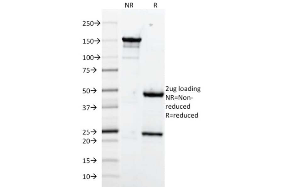 SDS-PAGE - Anti-VCAM1 Antibody [1.4C3] - BSA and Azide free (A253464) - Antibodies.com