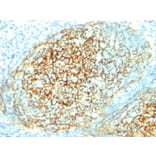 Immunohistochemistry - Anti-VCAM1 Antibody [1.4C3] - BSA and Azide free (A253463) - Antibodies.com