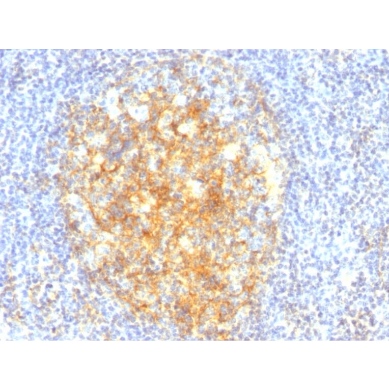 Immunohistochemistry - Anti-VCAM1 Antibody [VCAM1/843] - BSA and Azide free (A253464) - Antibodies.com