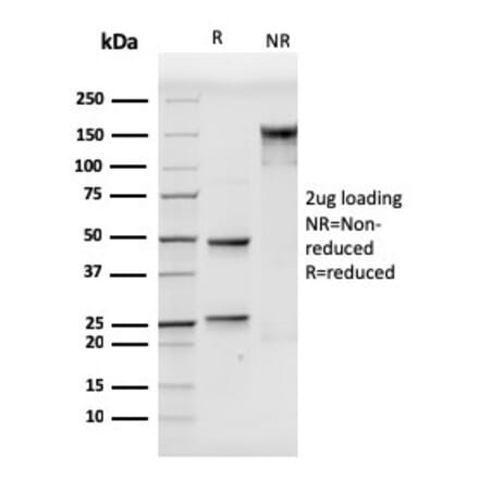 SDS-PAGE - Anti-VCAM1 Antibody [VCAM1/3499] - BSA and Azide free (A253466) - Antibodies.com
