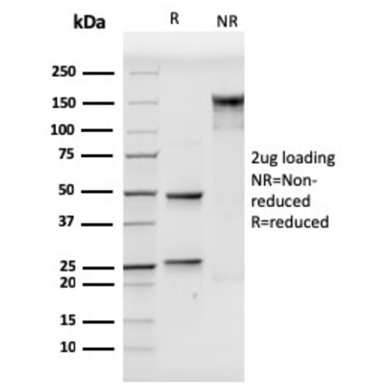 SDS-PAGE - Anti-VCAM1 Antibody [VCAM1/3499] - BSA and Azide free (A253466) - Antibodies.com