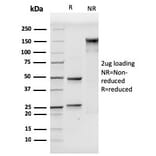 SDS-PAGE - Anti-VCAM1 Antibody [VCAM1/3499] - BSA and Azide free (A253466) - Antibodies.com
