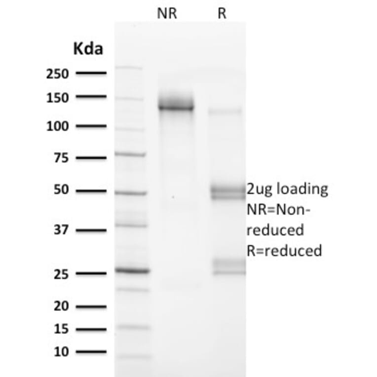 SDS-PAGE - Anti-Vinculin Antibody [VCL/2572] - BSA and Azide free (A253468) - Antibodies.com