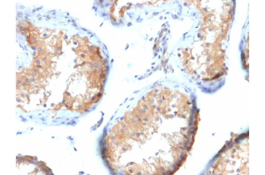 Immunohistochemistry - Anti-Vinculin Antibody [VCL/2573] - BSA and Azide free (A253469) - Antibodies.com