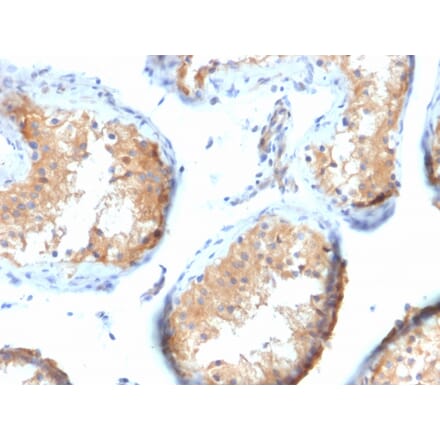 Immunohistochemistry - Anti-Vinculin Antibody [VCL/2573] - BSA and Azide free (A253469) - Antibodies.com