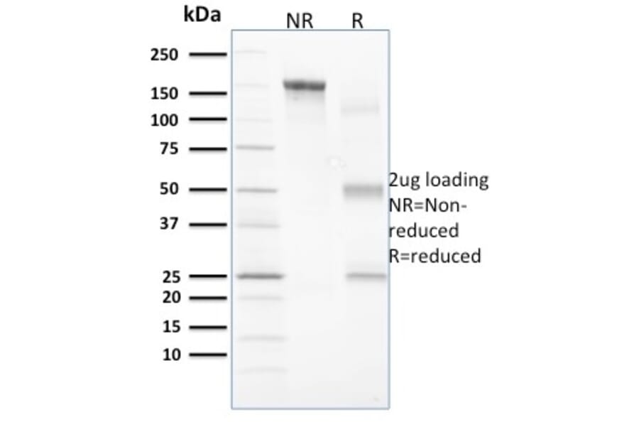 SDS-PAGE - Anti-Vinculin Antibody [VCL/2573] - BSA and Azide free (A253469) - Antibodies.com