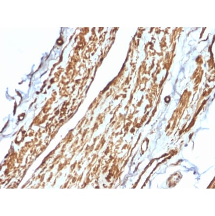 Immunohistochemistry - Anti-Vinculin Antibody [VCL/2575] - BSA and Azide free (A253470) - Antibodies.com