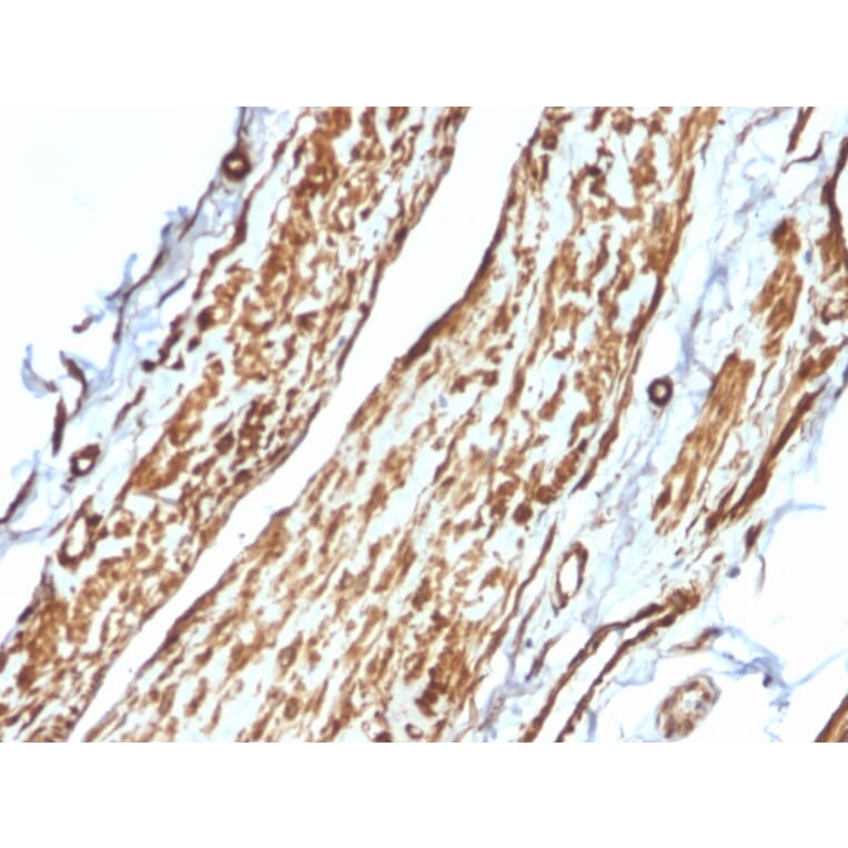 Immunohistochemistry - Anti-Vinculin Antibody [VCL/2575] - BSA and Azide free (A253470) - Antibodies.com