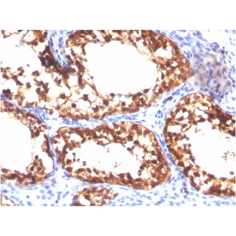 Immunohistochemistry - Anti-Vinculin Antibody [VCL/3617] - BSA and Azide free (A253471) - Antibodies.com