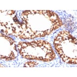 Immunohistochemistry - Anti-Vinculin Antibody [VCL/3617] - BSA and Azide free (A253471) - Antibodies.com