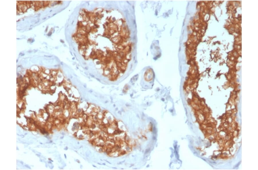 Immunohistochemistry - Anti-Vinculin Antibody [VCL/3617] - BSA and Azide free (A253471) - Antibodies.com
