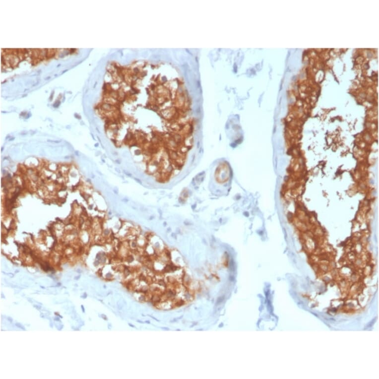 Immunohistochemistry - Anti-Vinculin Antibody [VCL/3617] - BSA and Azide free (A253471) - Antibodies.com