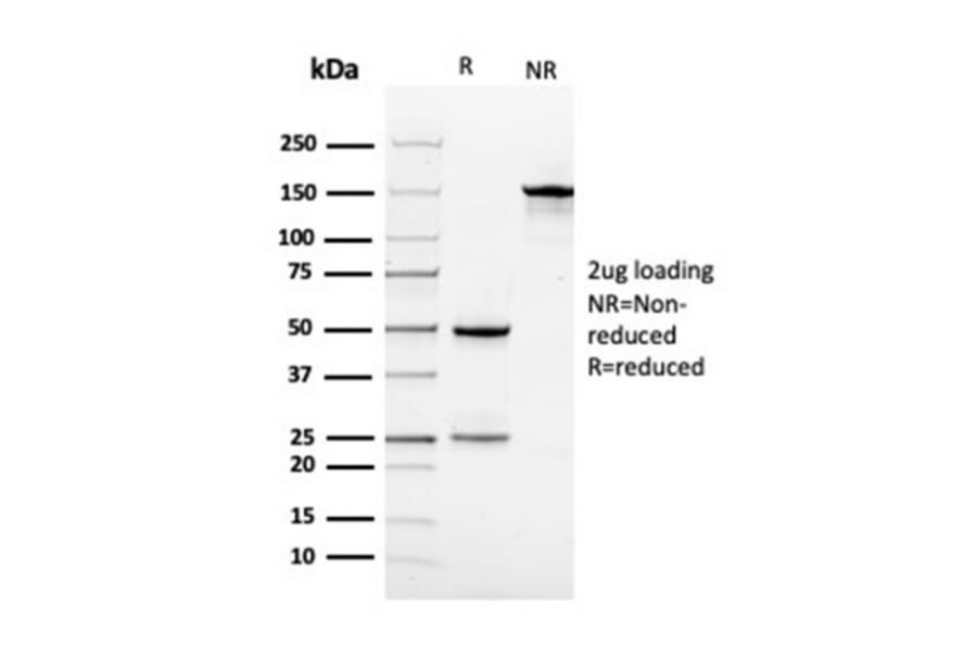 SDS-PAGE - Anti-Vinculin Antibody [VCL/3617] - BSA and Azide free (A253471) - Antibodies.com