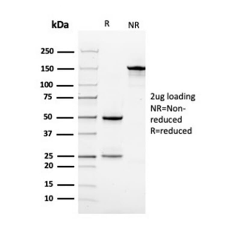 SDS-PAGE - Anti-Vinculin Antibody [VCL/3617] - BSA and Azide free (A253471) - Antibodies.com